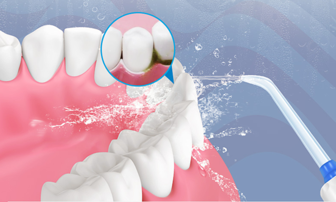 口腔健康遇危机?水牙线怎么用?